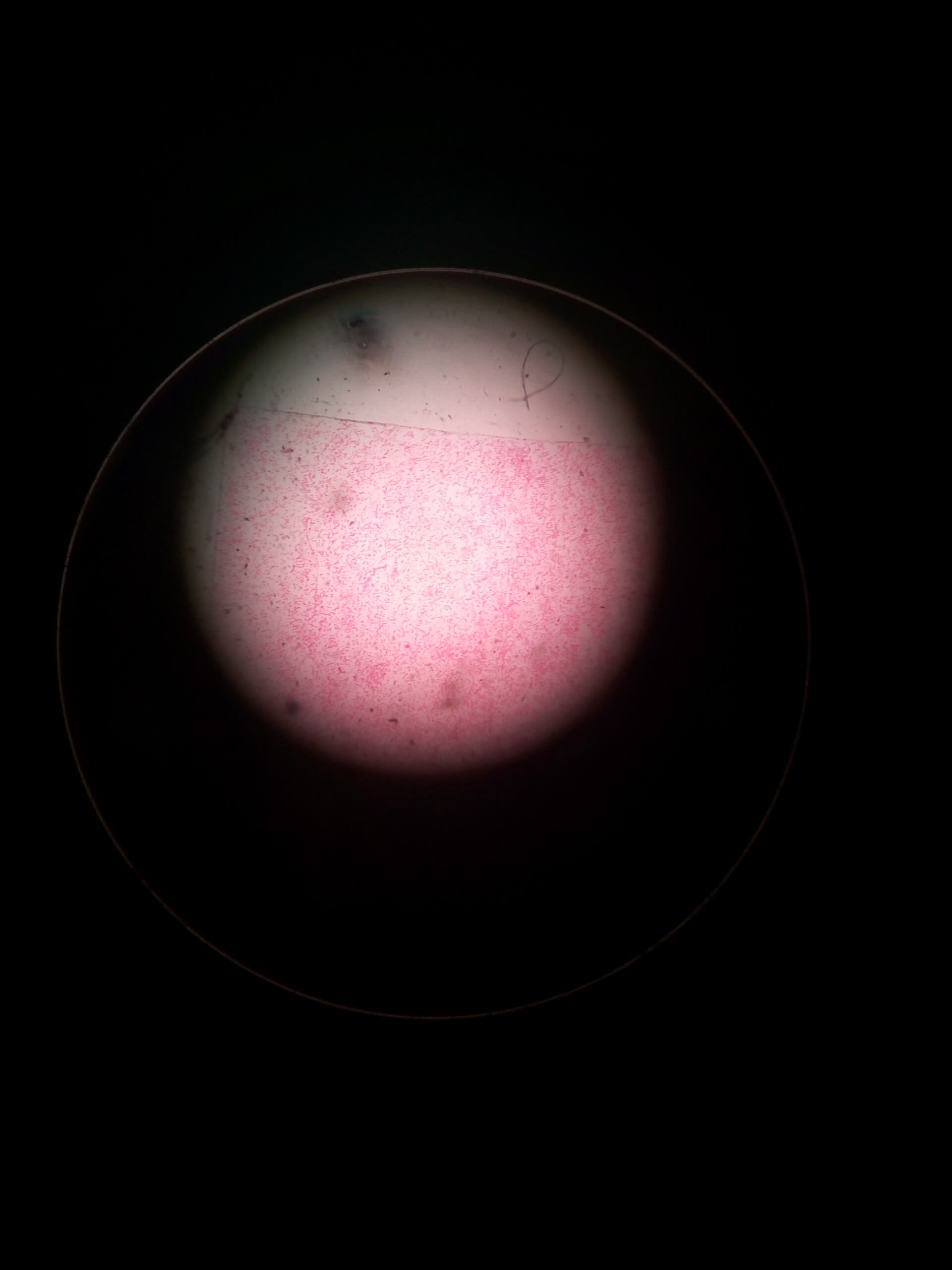Glóbulos rojos vistos al microscopio